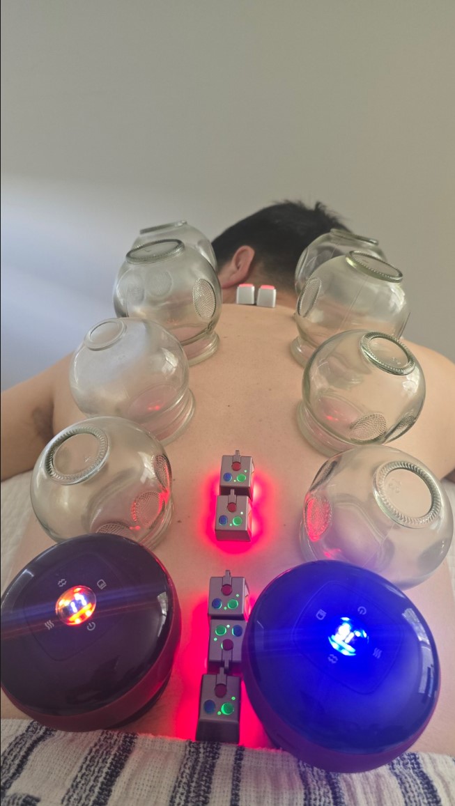 Cupping therapy treatment