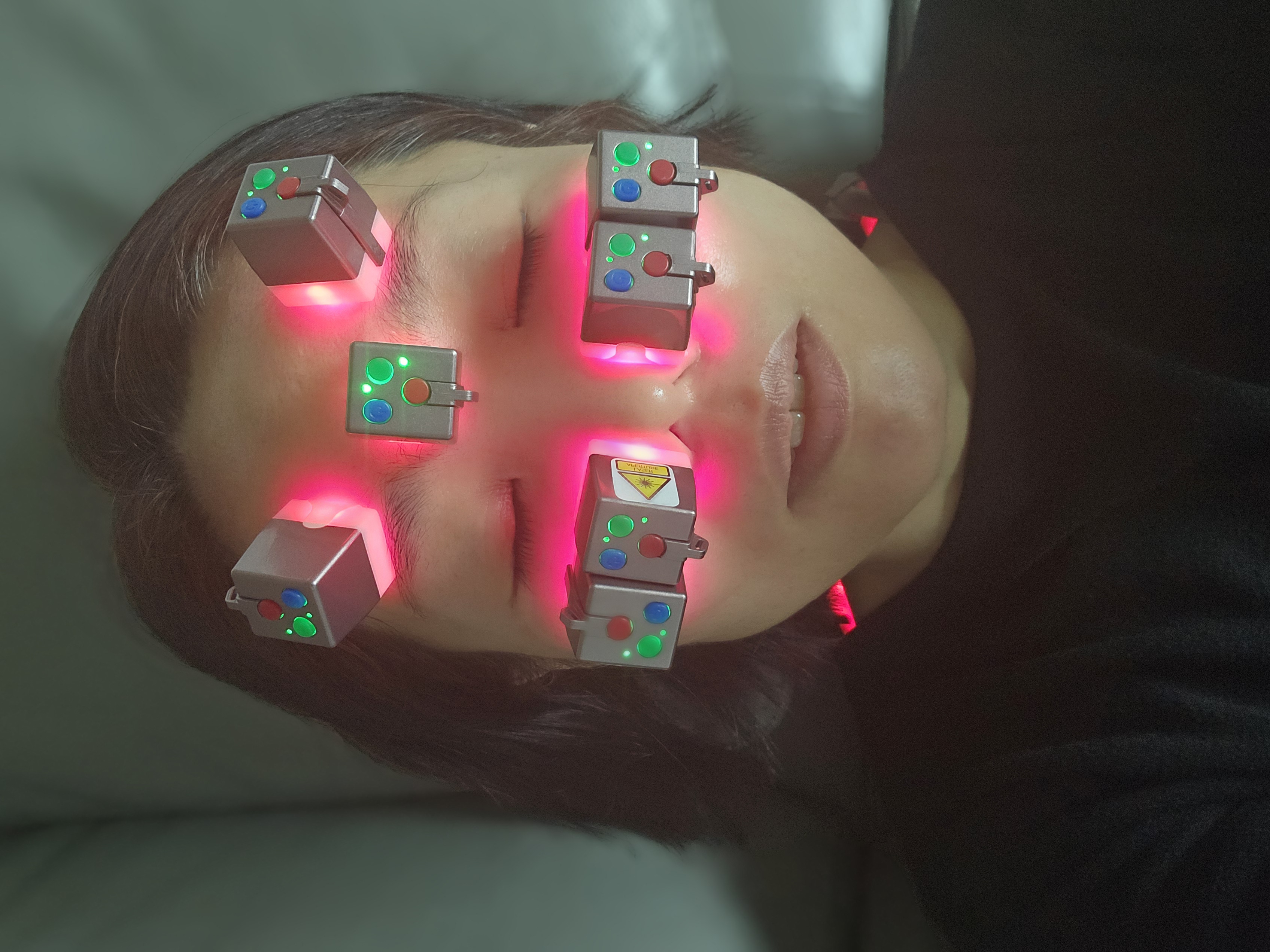 RootCare home-use device example on the face